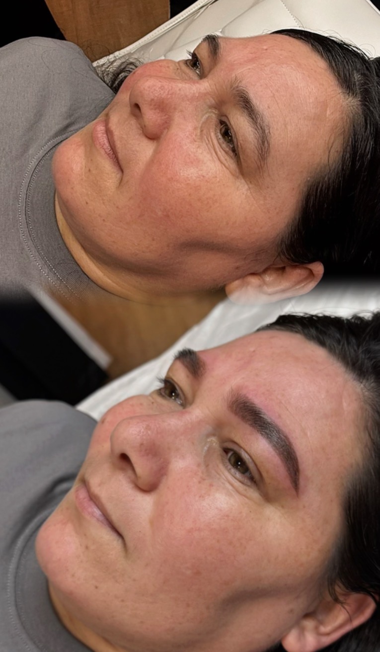 Close-up of a woman's face with freshly done eyebrows, lying down, with a neutral expression.