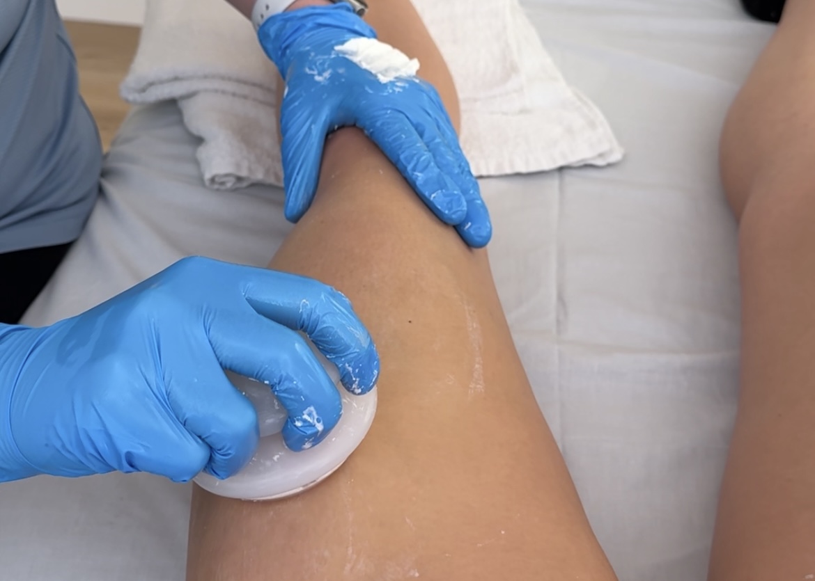 Person receiving a medical procedure on their leg with a healthcare worker using a sponge, both wearing blue gloves.