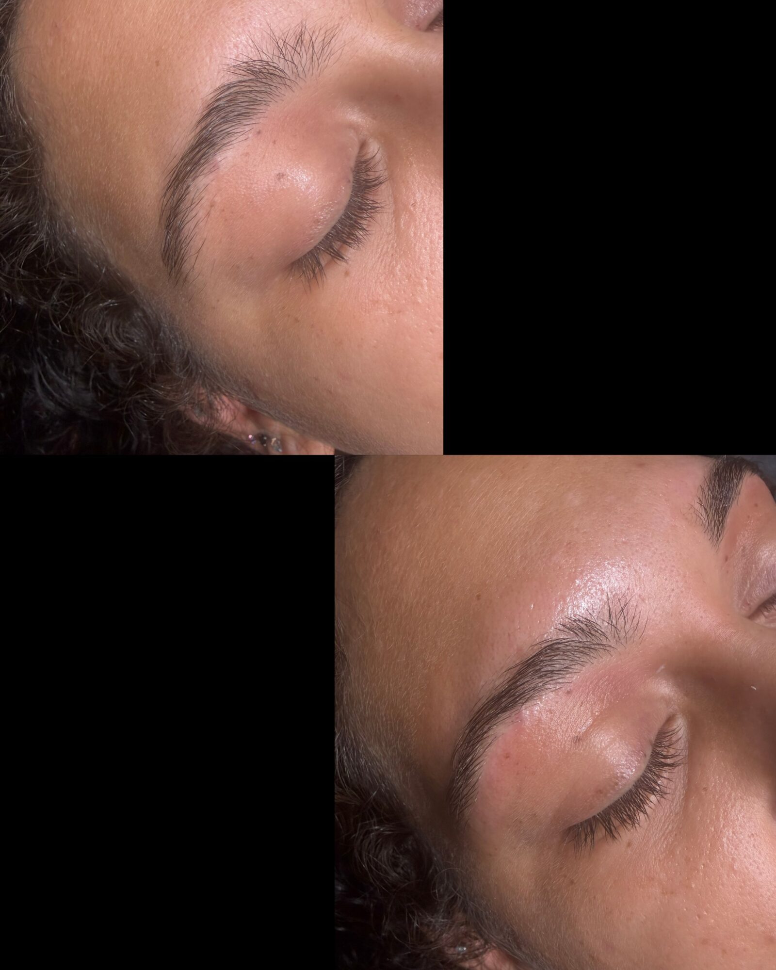 Close-up of a person's face with eyes closed, showing skin and eyebrows, rotated to upright position.