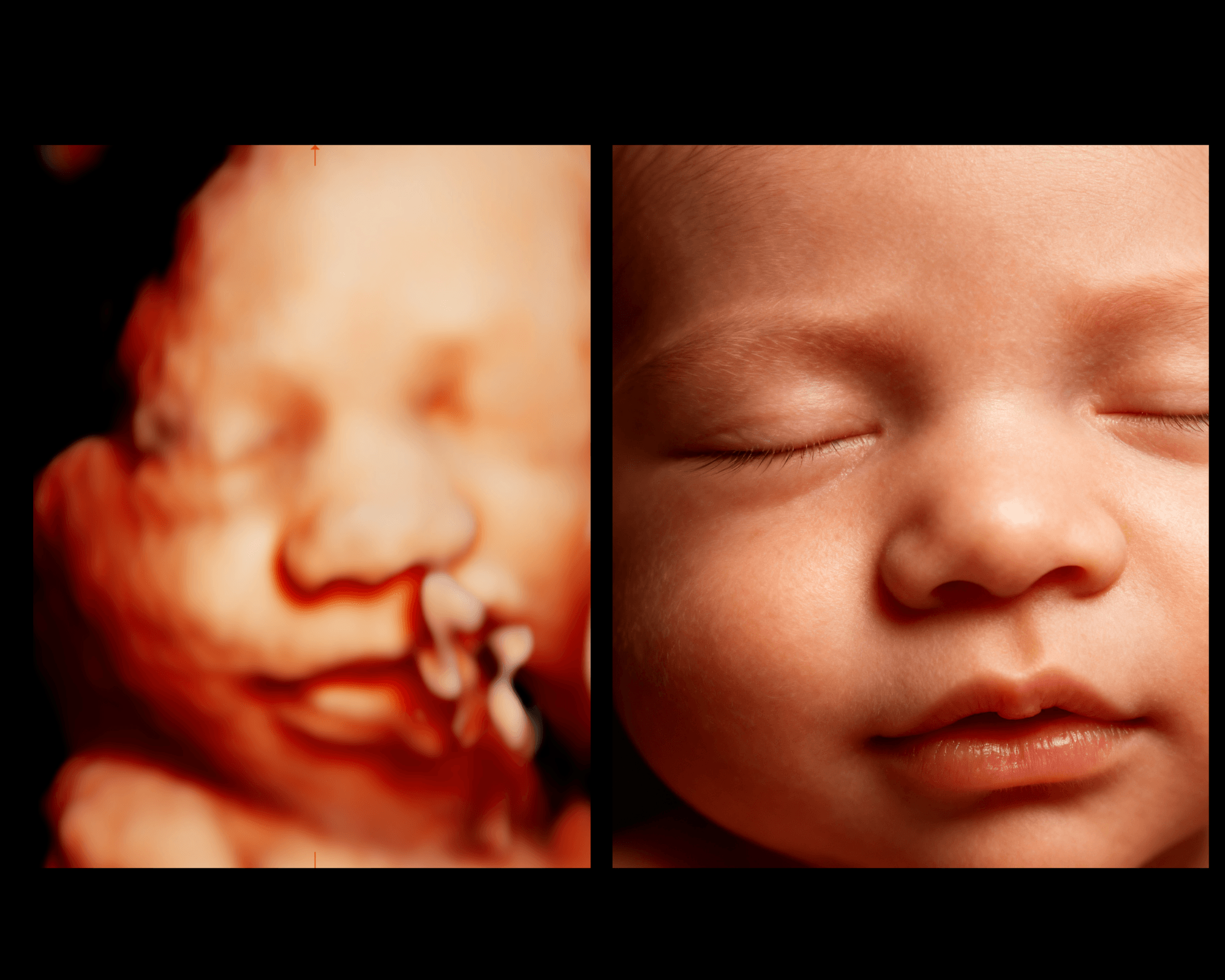 Two close-up images of sleeping babies, one with a 3D ultrasound and the other with a regular photograph.