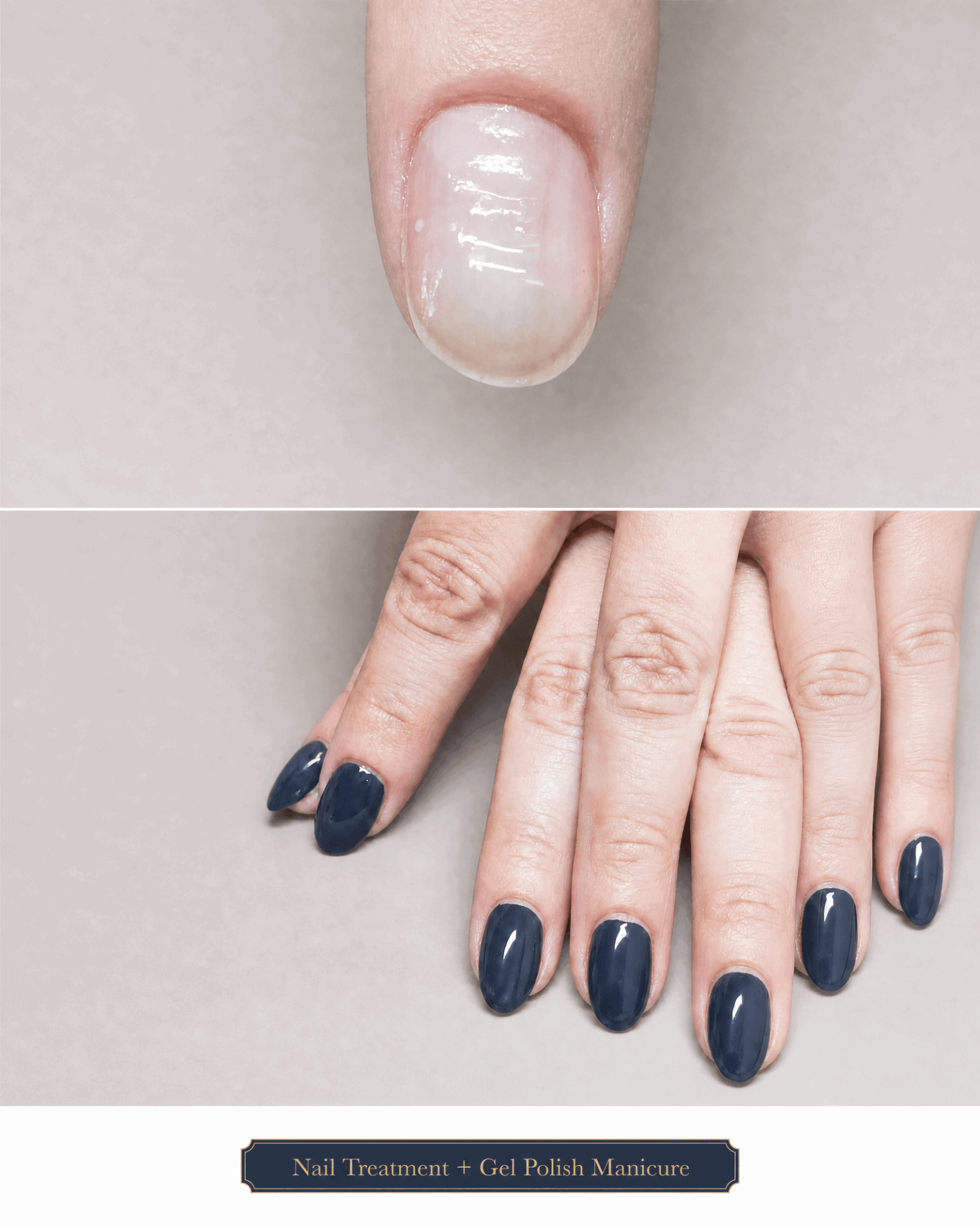 Close-up of a fingernail and a hand with dark blue painted nails, on a light background.