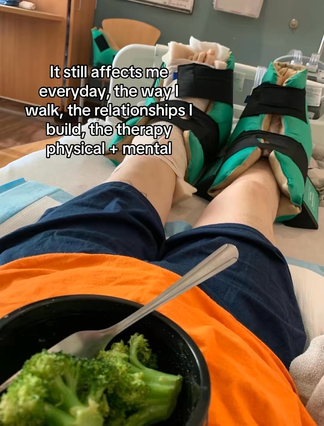 Person lying in a hospital room with legs elevated, wearing medical boots, with a bowl of broccoli and a spoon in foreground.
